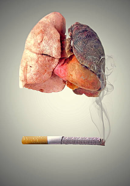 A cigarette smoking make lung cancer and take treatment at Santosh Homoeo Hall and Clinic