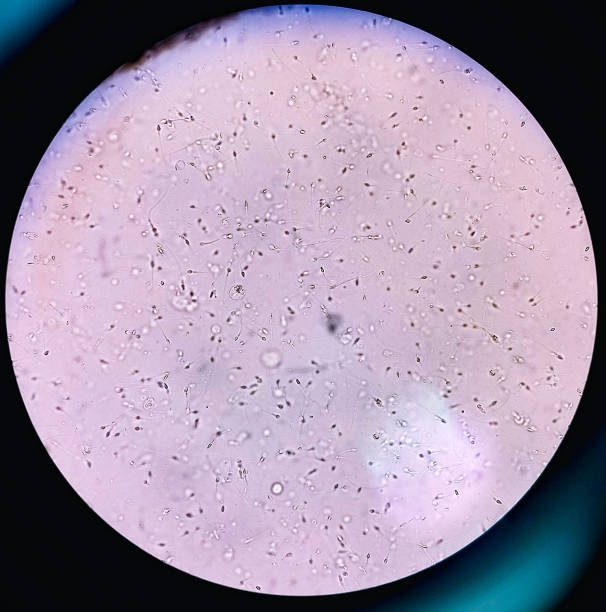 Picture show azoospermia and take homeopathic treatment at Santosh Homoeo Hall and clinic