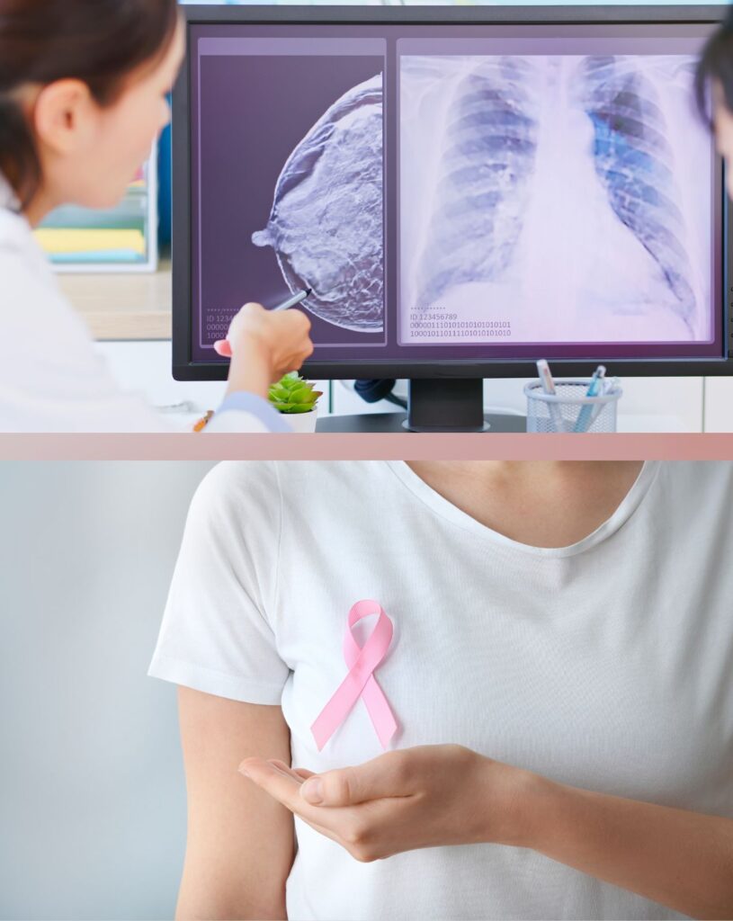 A picture show breast cancer and treatment at Santosh Homoeo Hall and Clinic