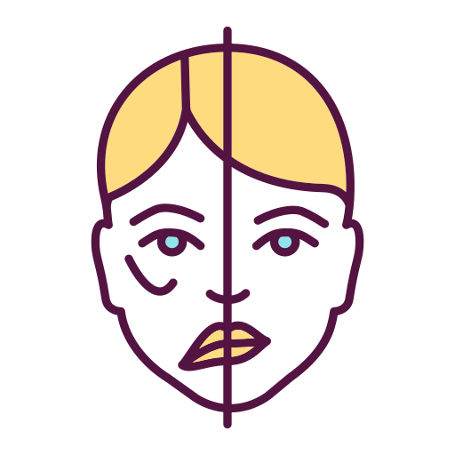 bells palsy