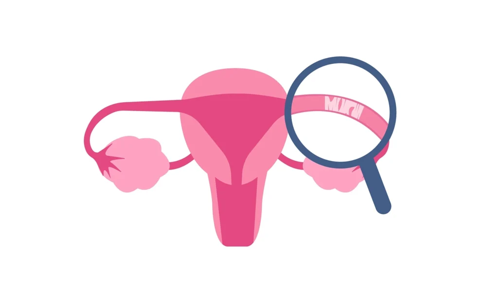 Image show fallopian tube block and take homeopathic treatment at Santosh Homoeo Hall and clinic