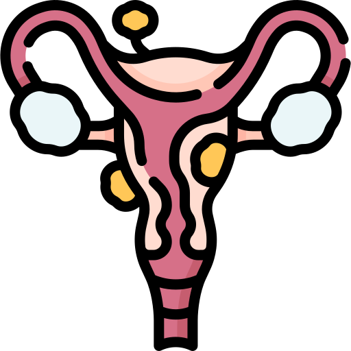 uterine fibroid