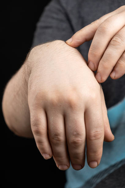 A hand show ganglion and treatment at Santosh Homoeo Hall and clinic