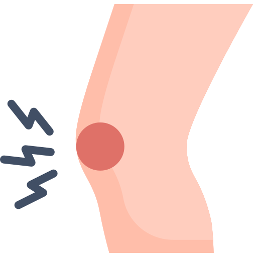joint diseases