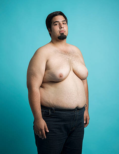 A man suffer from gynecomastia and treatment at Santosh Homoeo Hall and clinic