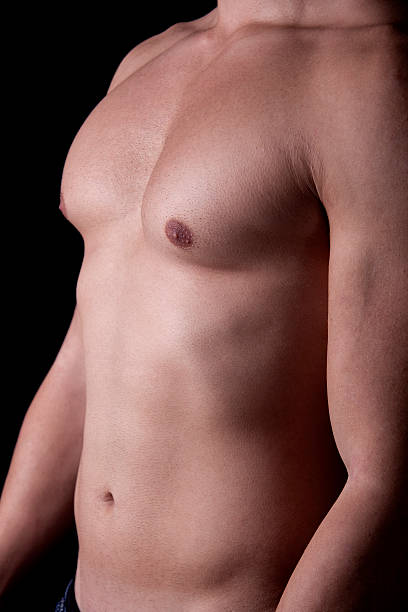 A picture of gynecomastia and take treatment at Santosh Homoeo Hall and Clinic