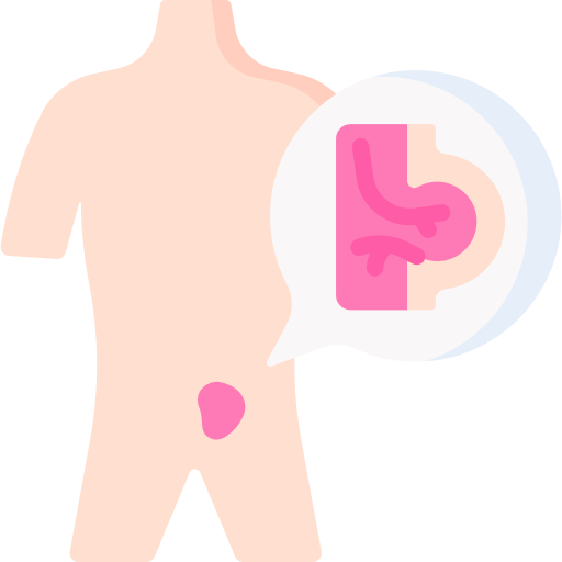 inguinal hernia