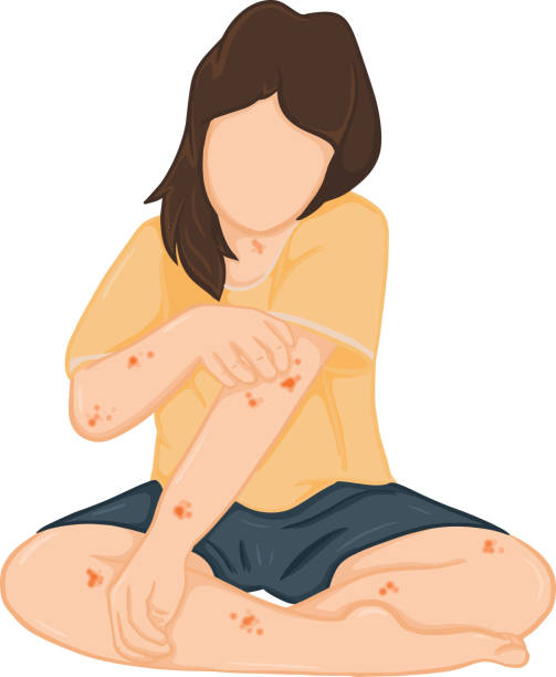 rashes treatment at santosh homeo hall and cliniic