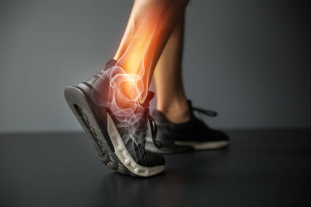 Ankle joint pain and take homeopathic treatment at Santosh Romeo Holland Clinic