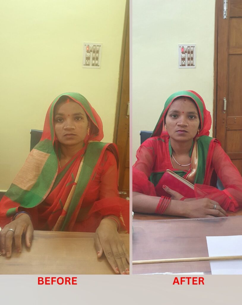 Bell's palsy homeopathic treatment at Santosh Homoeo Hall and Clinic