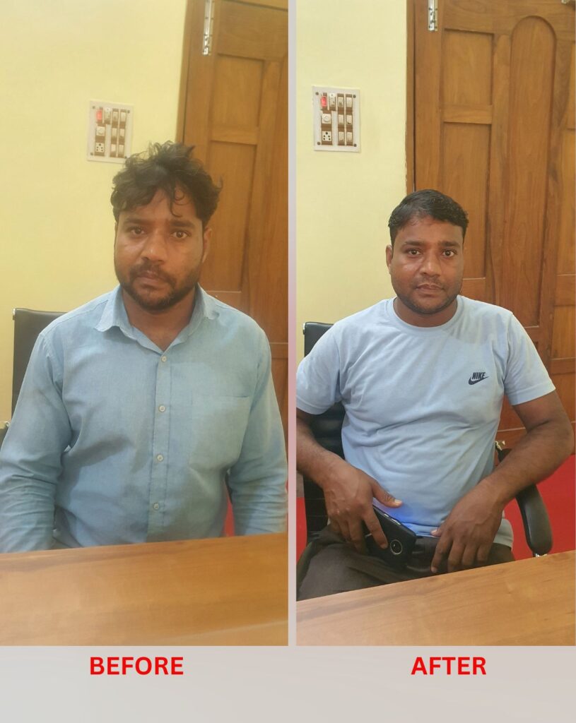 bell's palsy homeopathic treatment at Santosh Homoeo Hall and clinic