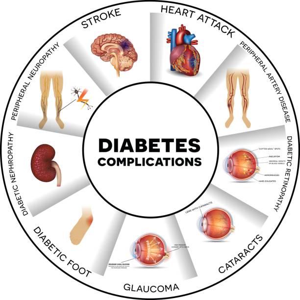 Image show complication of diabetes and take homeopathic treatment at Santosh homoeo Hall and Clinic