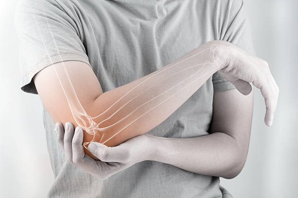 A picture of elbow, joint pain and take homeopathic treatment at Santosh Homoeo Hall and Clinic