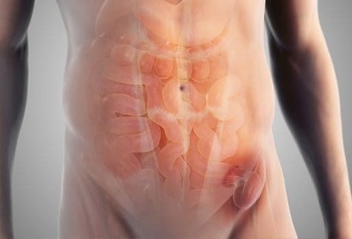 Inguinal hernia, and take homeopathic treatment at Santosh Homoeo Hall and Clinic