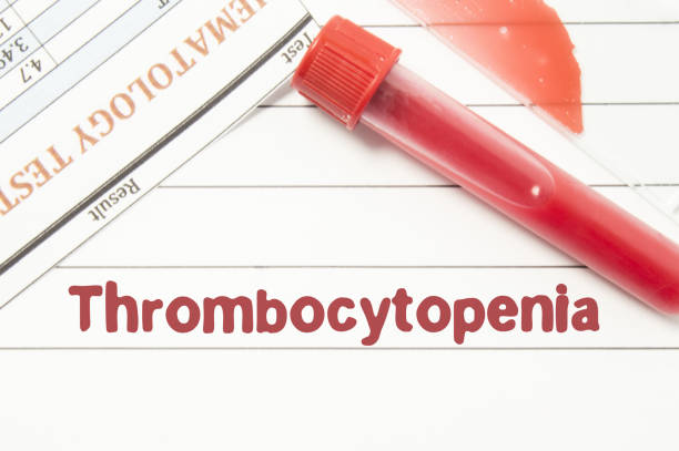 A picture of low platelet and take homeopathic treatment at Santosh Homoeo Hall and Clinic Monday, Monday, Monday