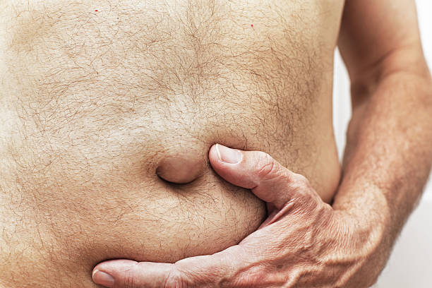 umblical hernia and take homeopathic treatment at Santosh homeo hall and clinic