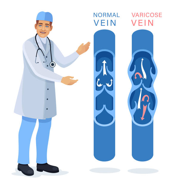 A doctor tell difference between normal veins and varicose veins and take homeopathic treatment at Santosh homoeo Hall and Clinic